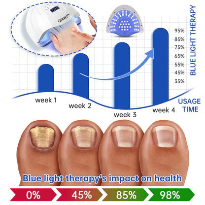 ✨ Last Day Discount: 62% OFF 🌸 QIAWI™ PureNail Fungus Laser Device-🗽Made and Shipped from USA👏